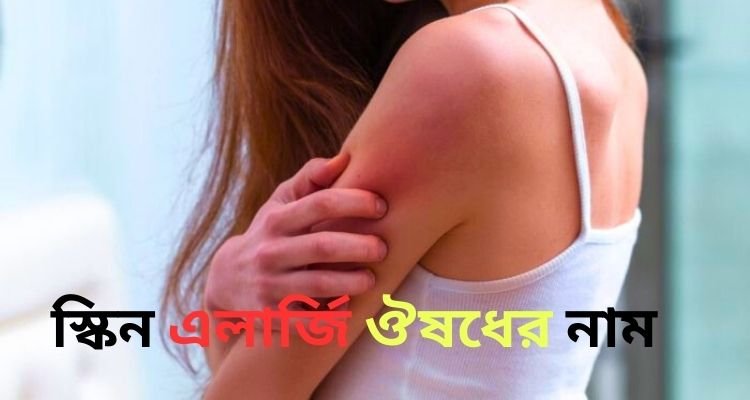 স্কিন এলার্জি ঔষধের নাম